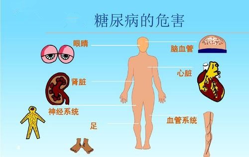 用空气负离子理疗仪治疗糖尿病